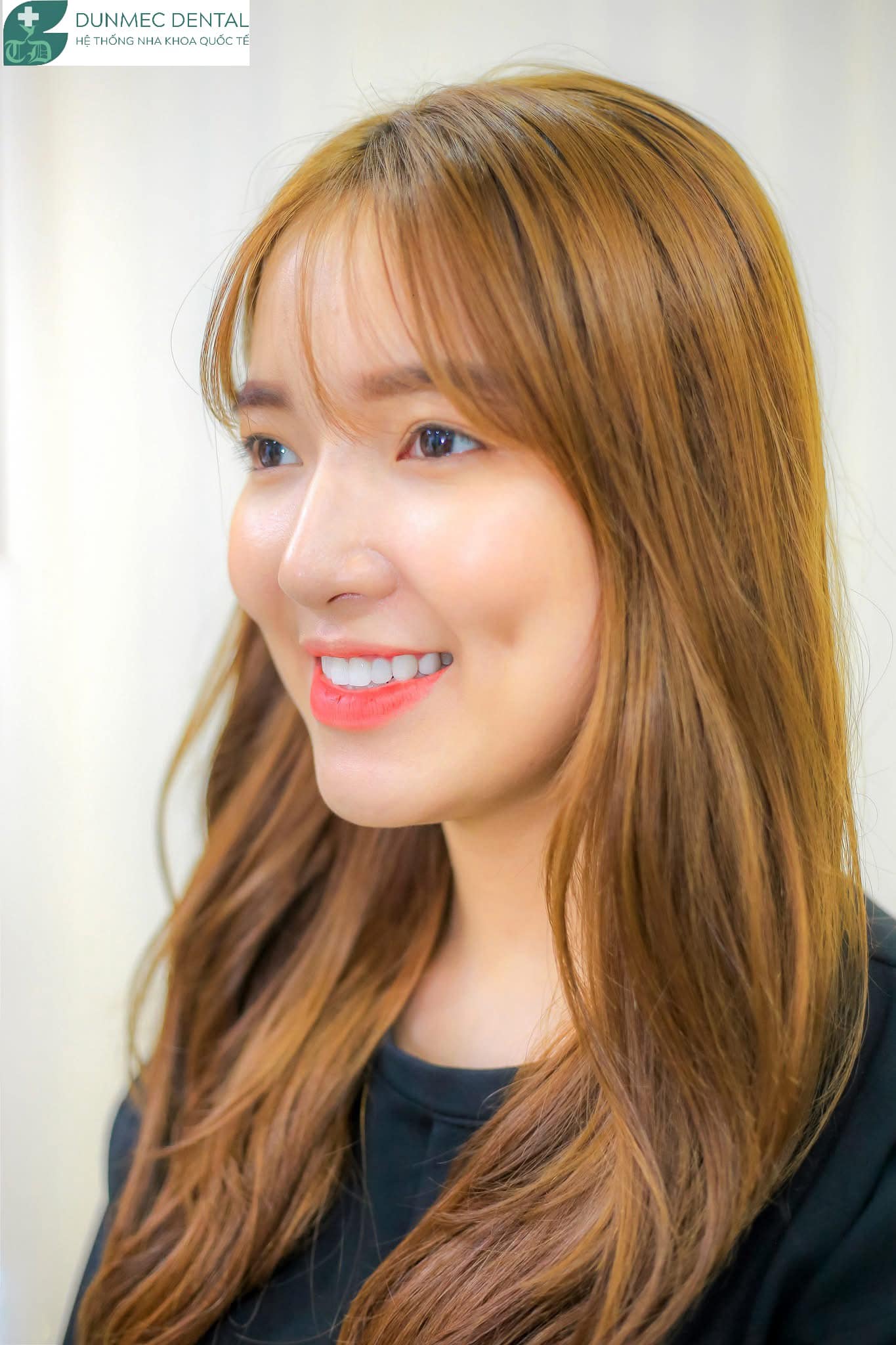 Răng Sứ Thẩm Mỹ – Giải Pháp Nâng Tầm Nụ Cười Tại Nha Khoa Dunmec