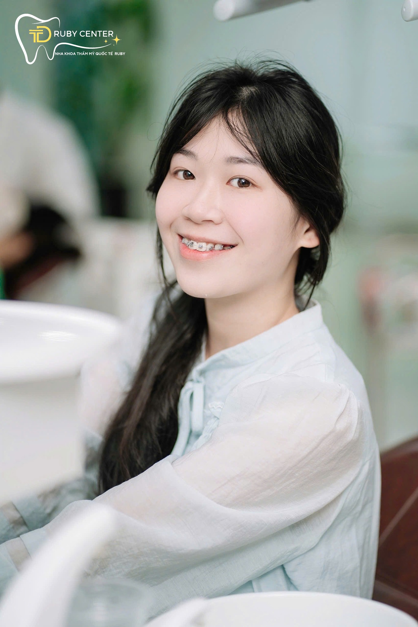 7 nỗi đau sẽ biến mất khi niềng răng tại Dunmec Dental