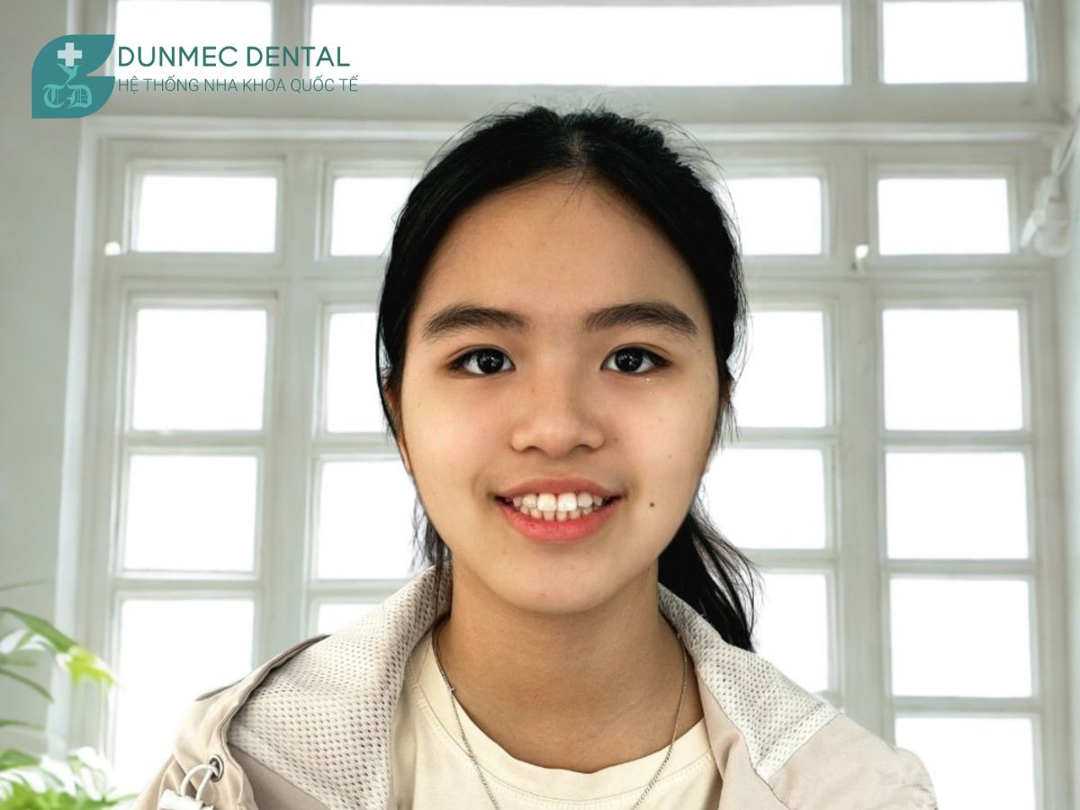 NGÀY ĐẦU TIÊN GẮN MẮC CÀI – BẮT ĐẦU HÀNH TRÌNH MỚI CÙNG DUNMEC