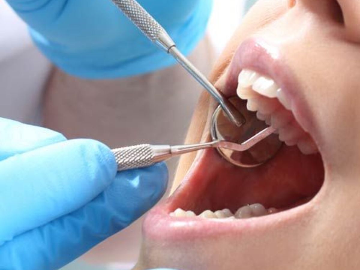 13 cách làm trắng răng bị ố vàng lâu năm hiệu quả