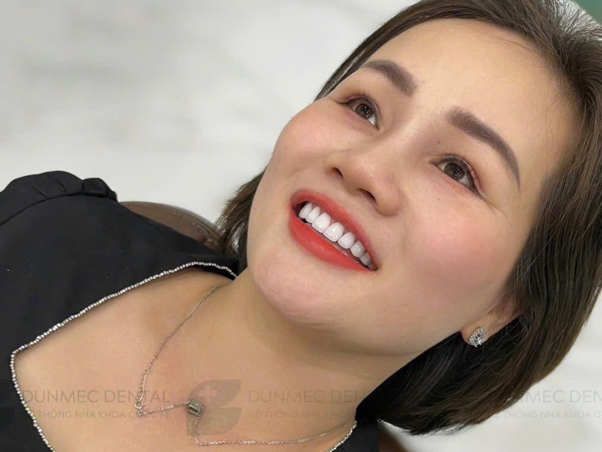Các Phương Pháp Cải Thiện Nụ Cười Phổ Biến Hiện Nay: Nên Chọn Giải Pháp Nào?