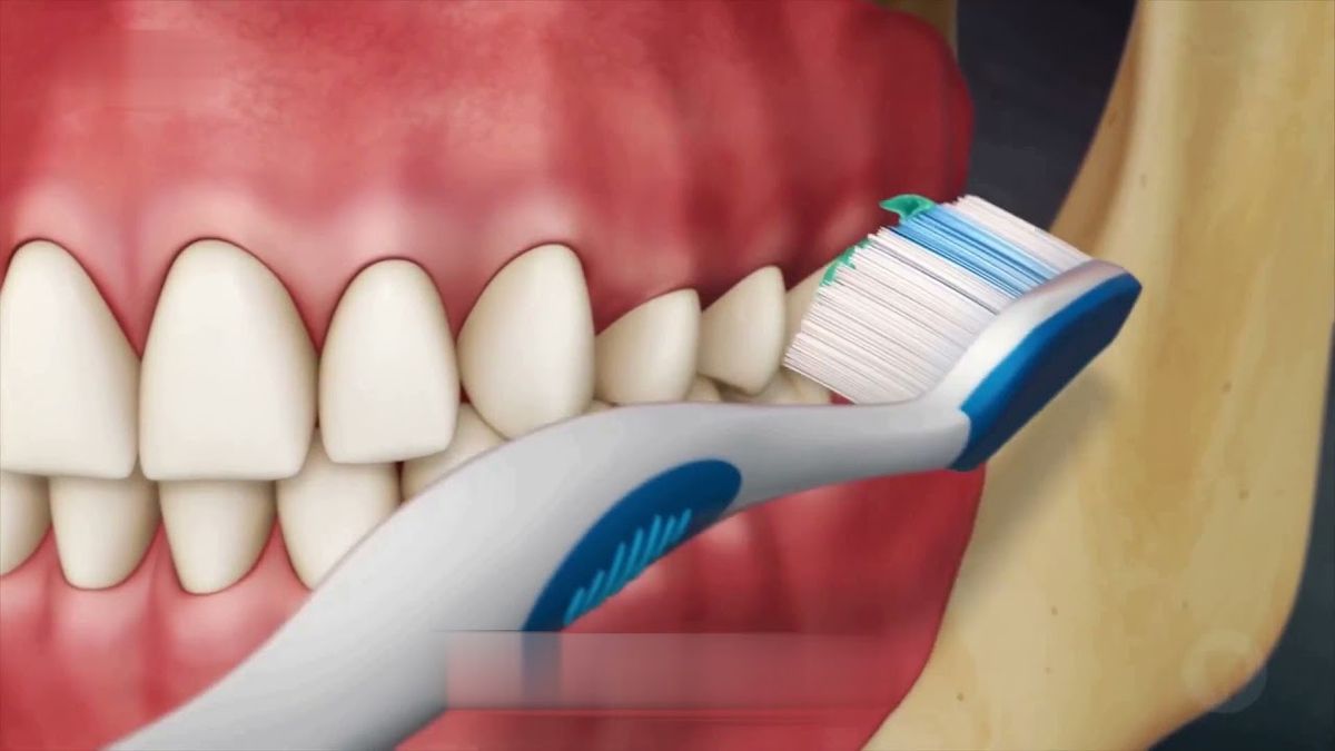 Giải đáp: Tụt lợi có thật sự nguy hiểm cho răng miệng?