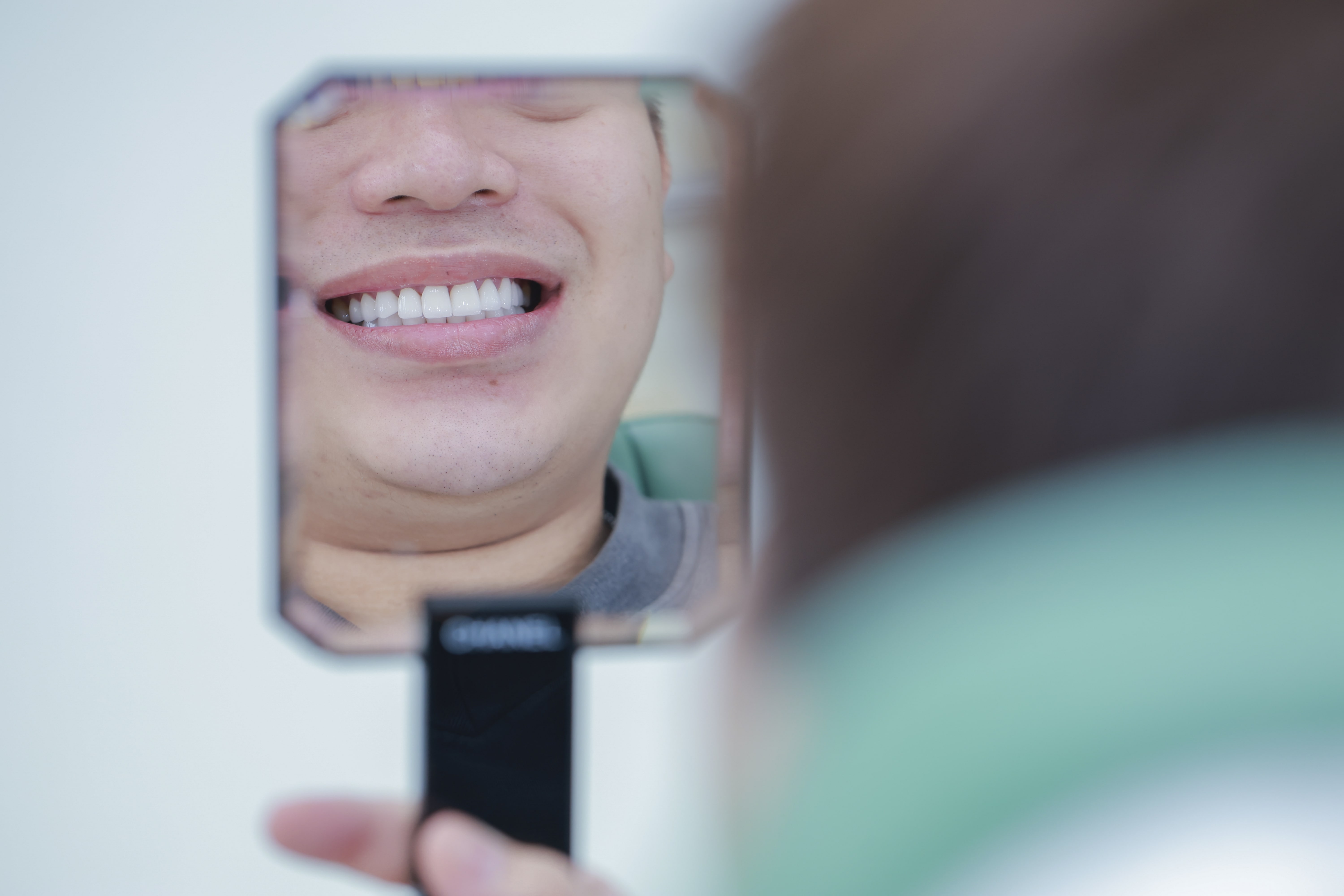 CẮM GHÉP IMPLANT TẠI DUNMEC DENTAL – GIẢI PHÁP HOÀN HẢO CHO NGƯỜI MẤT RĂNG