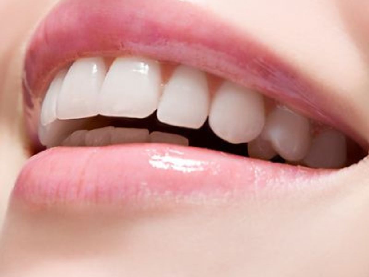 Yếu tố nào quyết định độ bền và độ đẹp của răng sứ