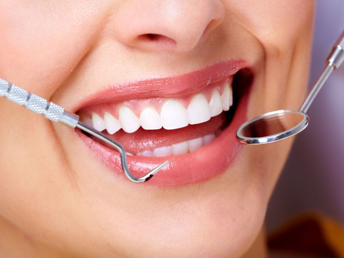 Vì sao cần khám răng định kỳ sau khi làm răng sứ? Lời khuyên từ bác sĩ