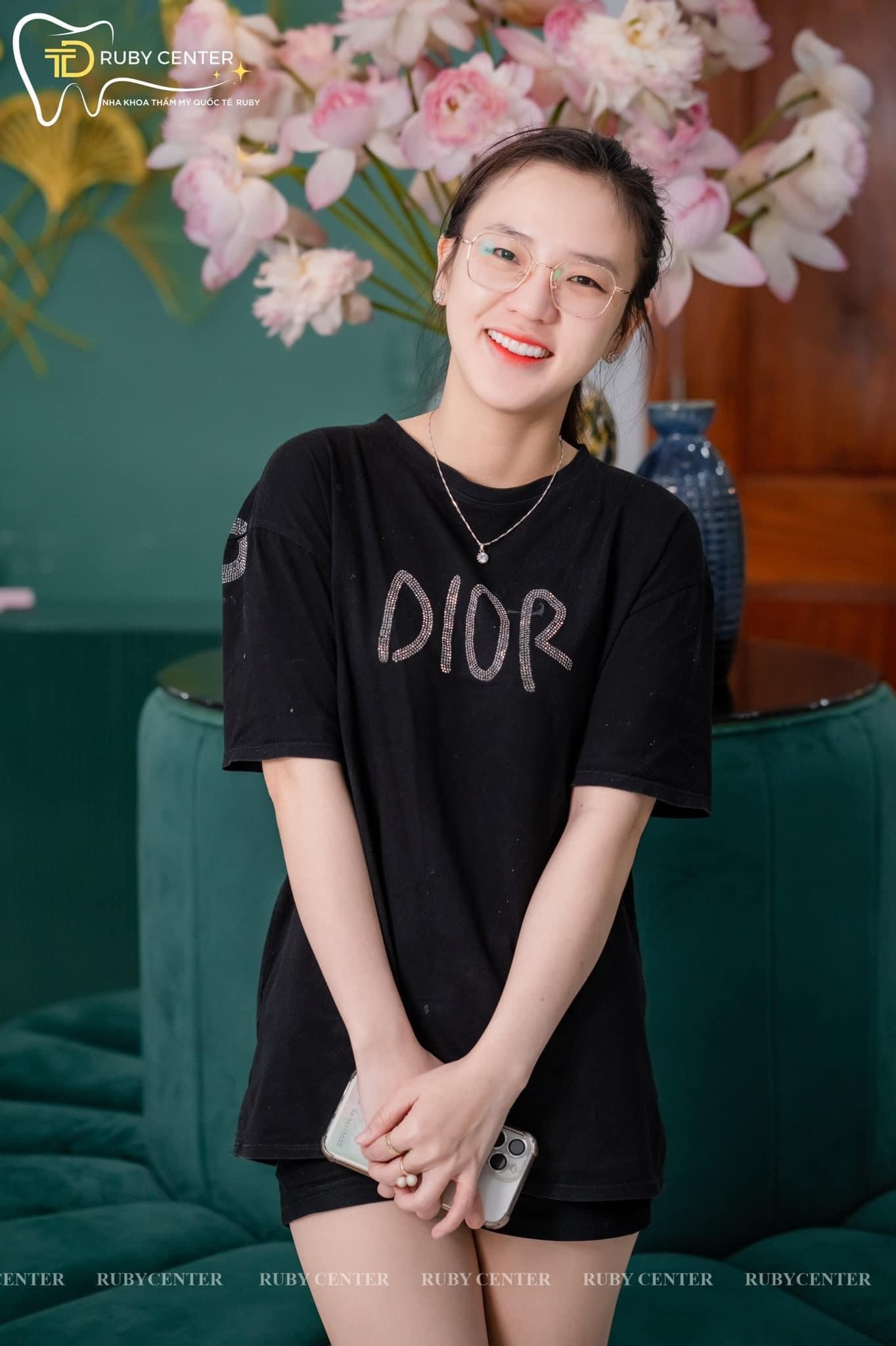 Dán Sứ Veneer Ít Xâm Lấn – Giải Pháp Thẩm Mỹ Giữ Trọn Răng Thật, Đẹp Tự Nhiên