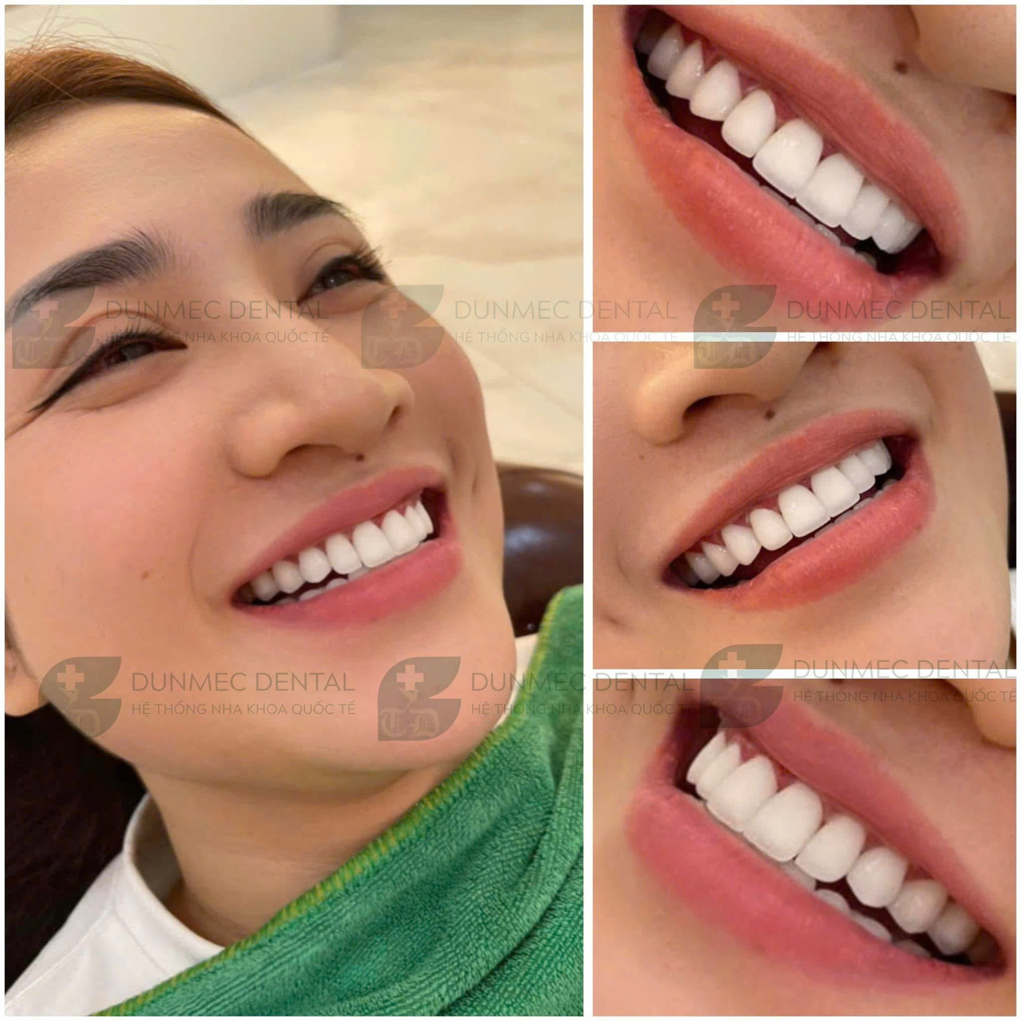 LƯU TRỮ NỤ CƯỜI TỰ TIN - TẠI DUNMEC