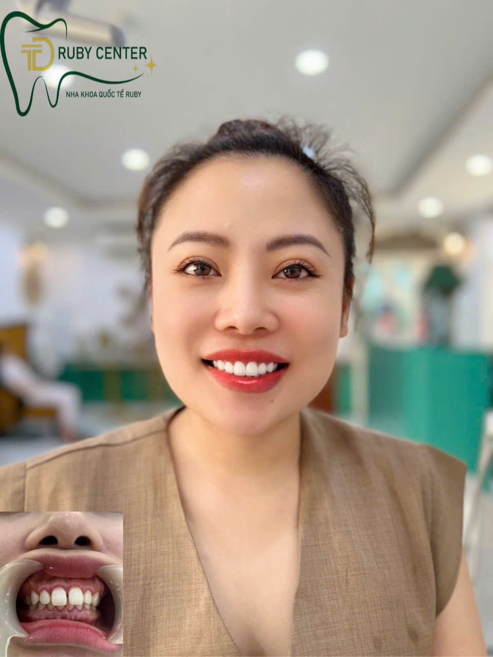 Nha khoa Dunmec Sài Gòn – Không gian sang trọng, an toàn tuyệt đối