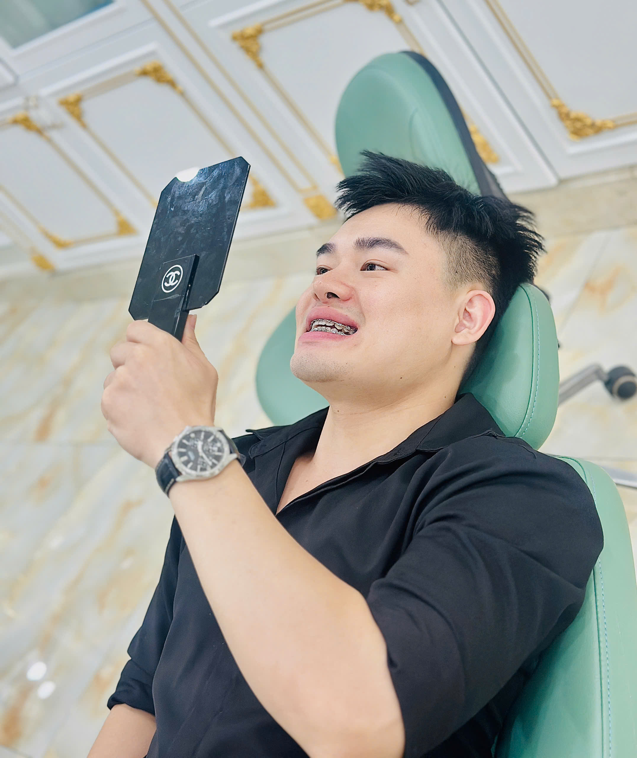 Nên niềng răng không? Những điều cần lưu ý trước khi niềng