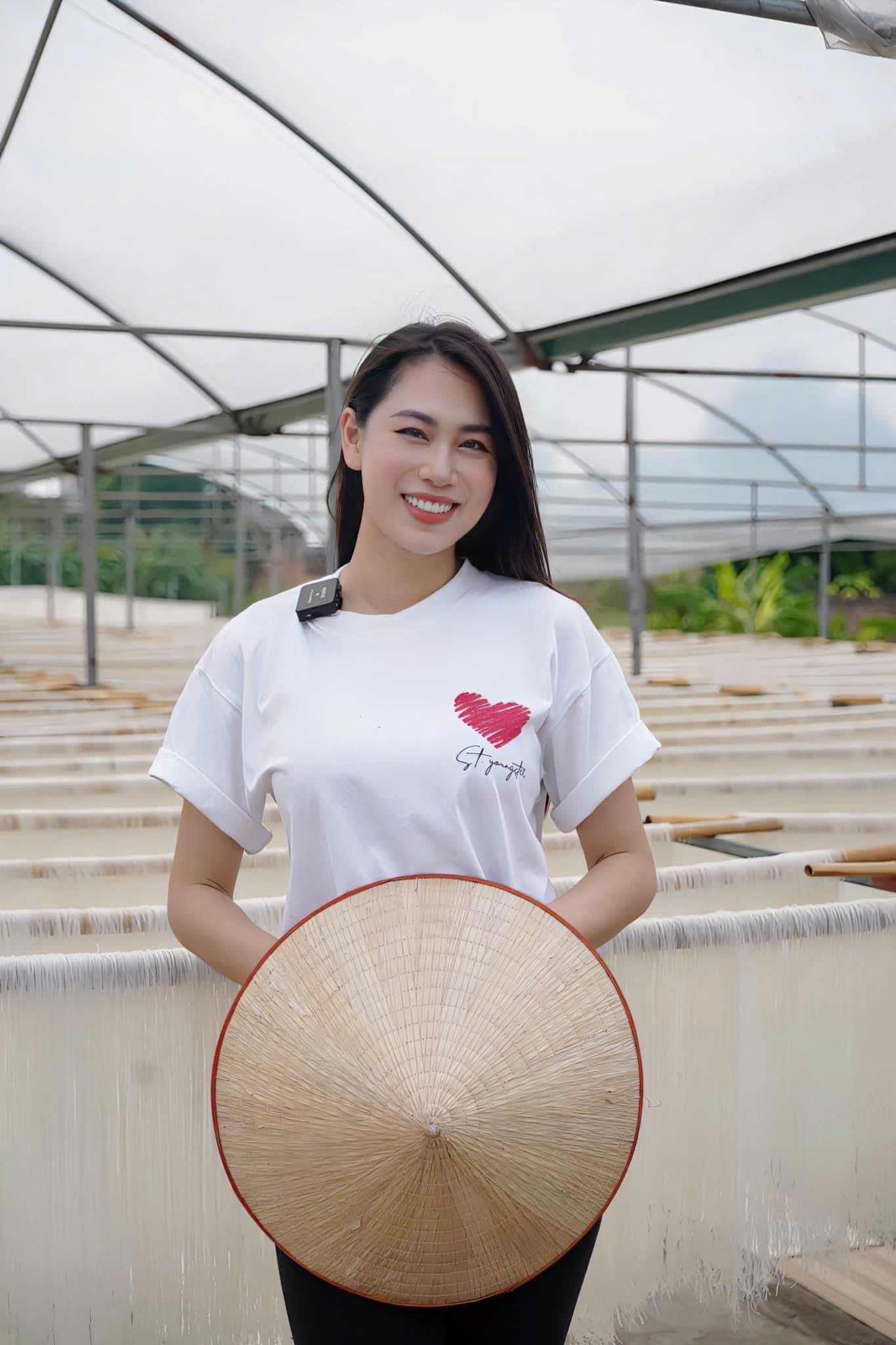 TRƯỚC VÀ SAU KHI LÀM RĂNG SỨ – SỰ THAY ĐỔI KHÓ TIN