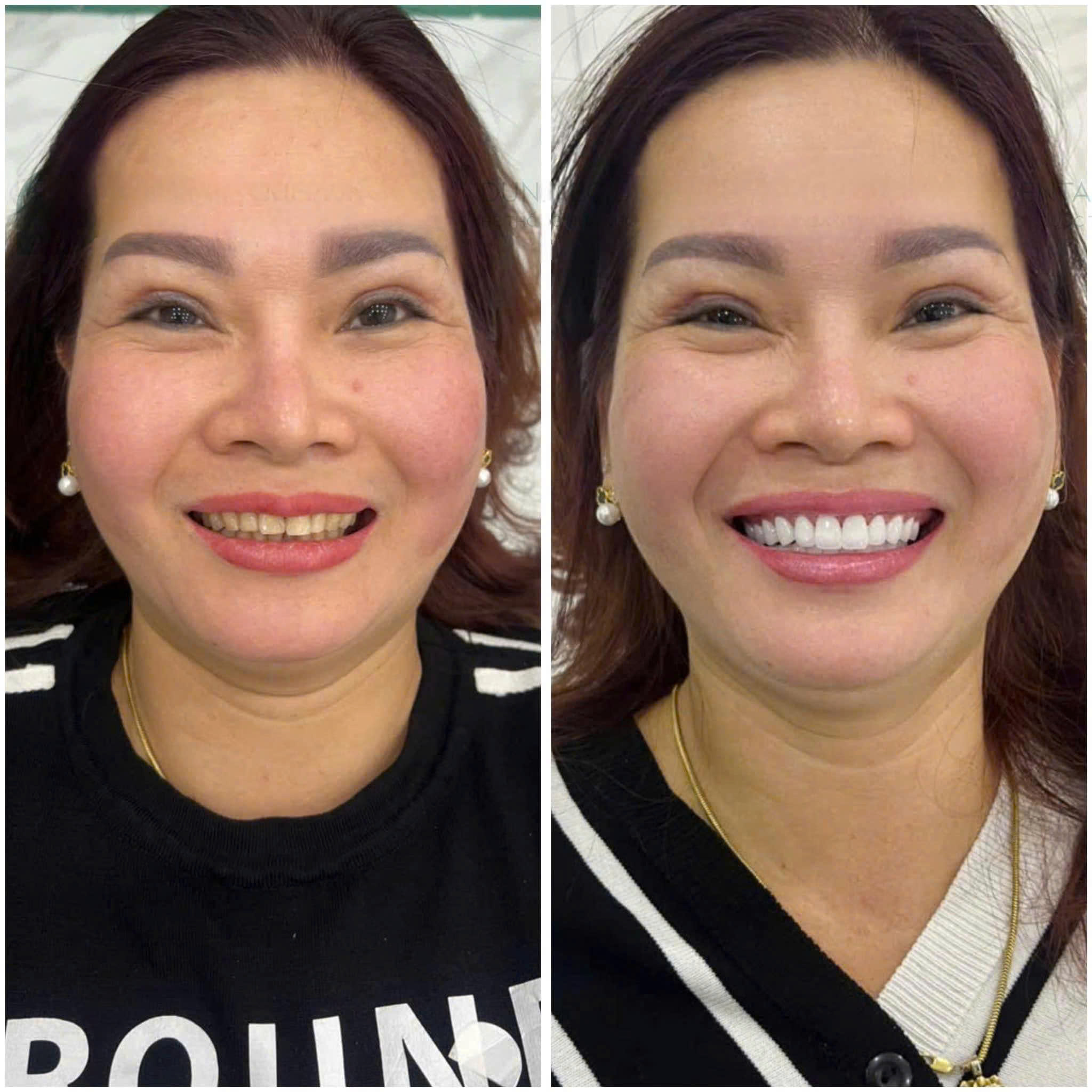 Dunmec Dental - Nơi nụ cười được “tái sinh”