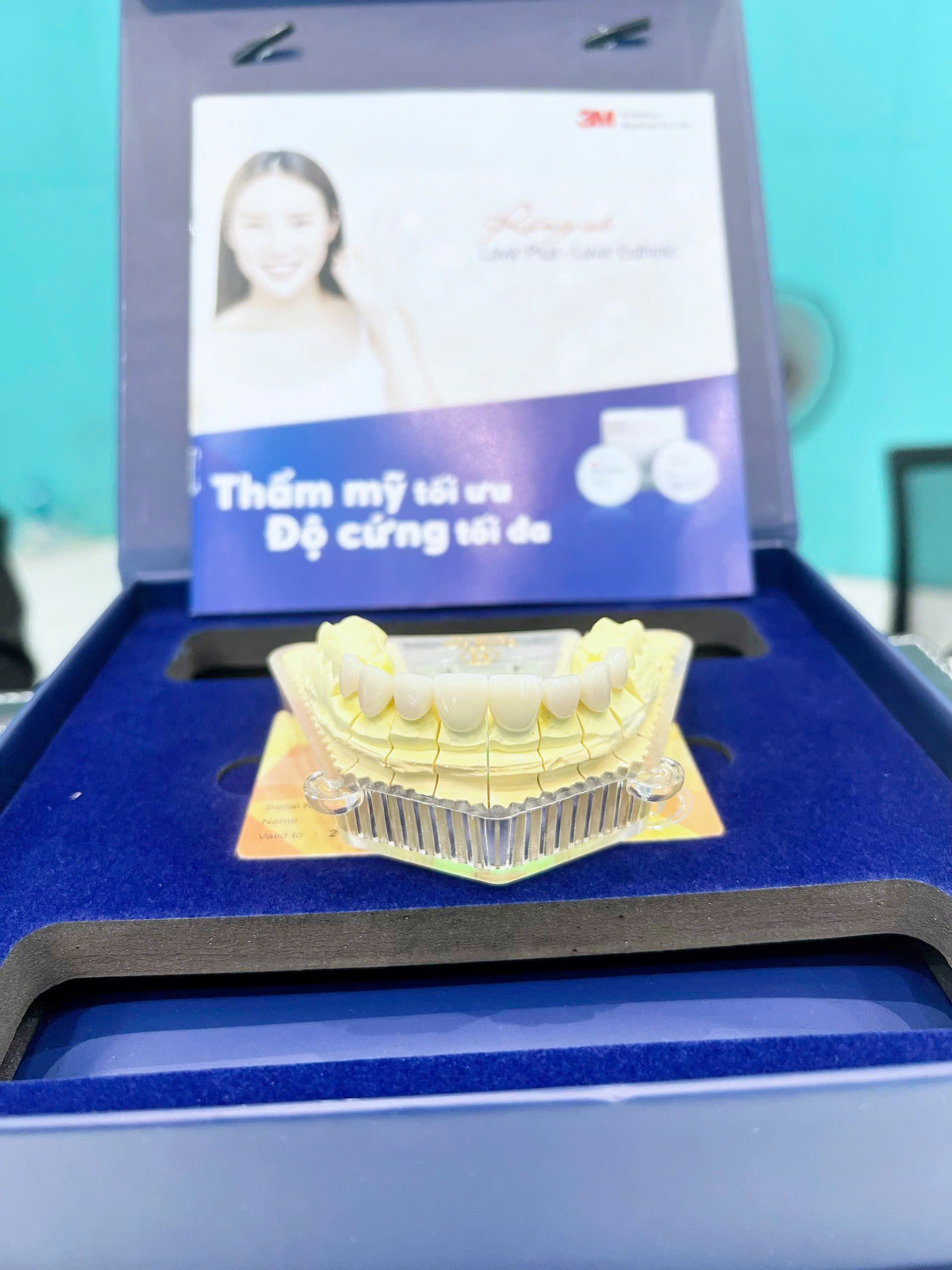 Thay áo mới cho răng xỉn màu – Bước khởi đầu cho một nụ cười tự tin