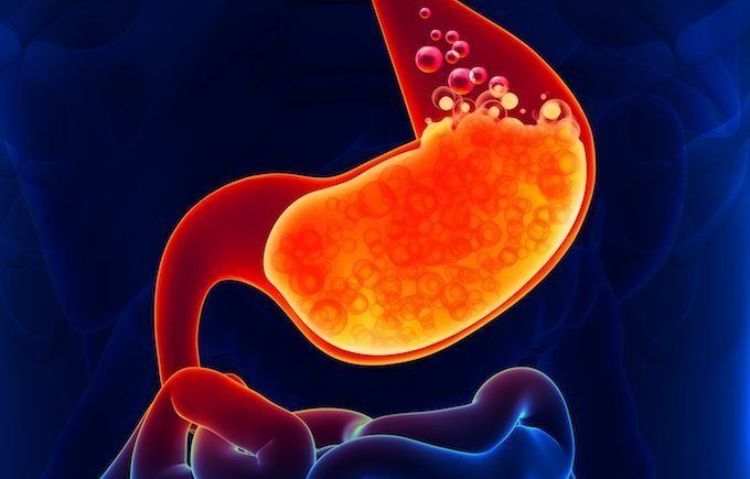 Gừng ngâm mật ong chữa trào ngược dạ dày có hiệu quả không?