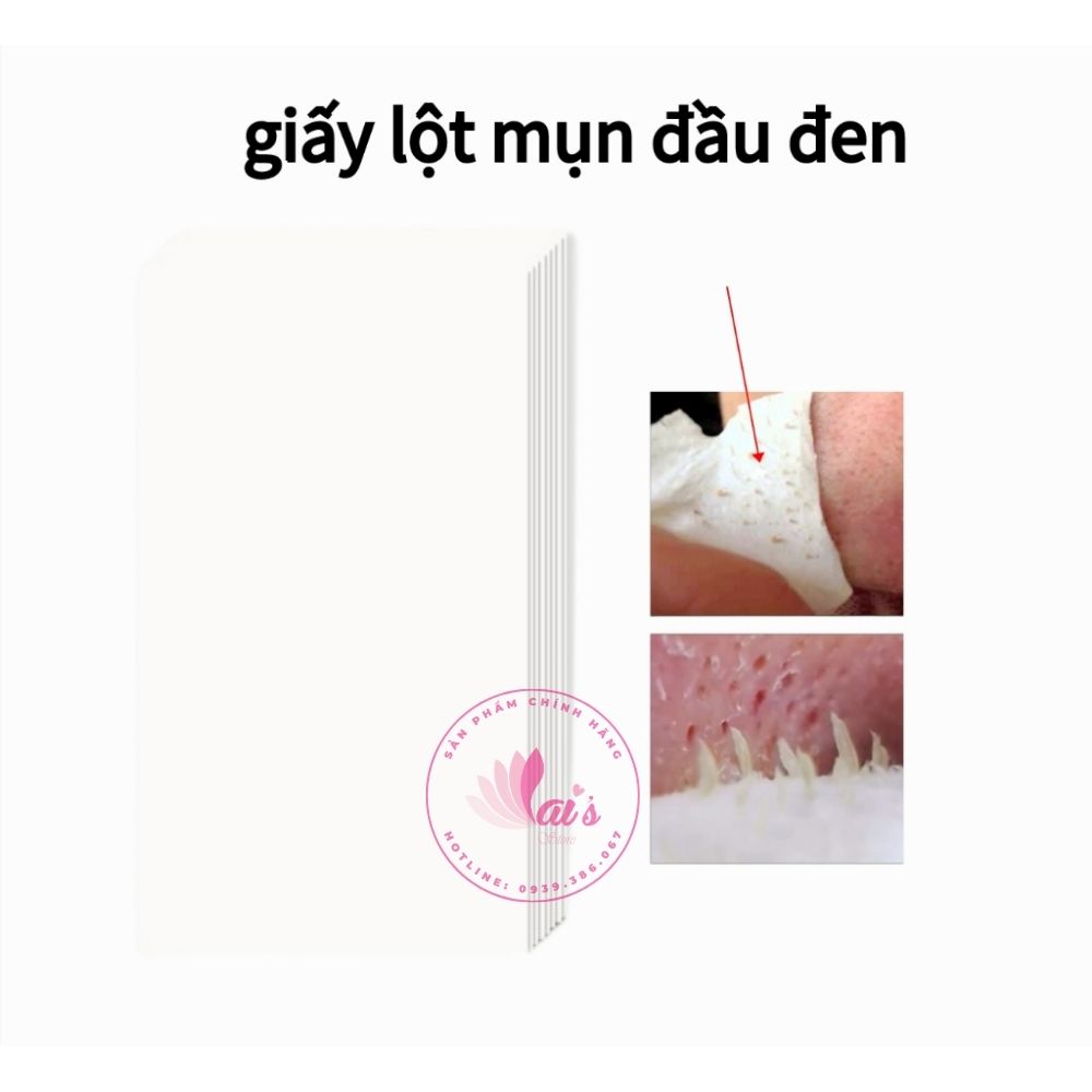 Giấy Lột Mụn Đầu Đen, Mụn Cám Lanbena Dùng Kèm Gel Lột Mụn Lanbena 80 Miếng / 120 Miếng
