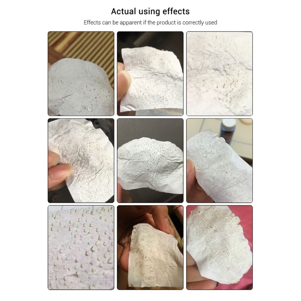 Giấy Lột Mụn Đầu Đen, Mụn Cám Lanbena Dùng Kèm Gel Lột Mụn Lanbena 80 Miếng / 120 Miếng