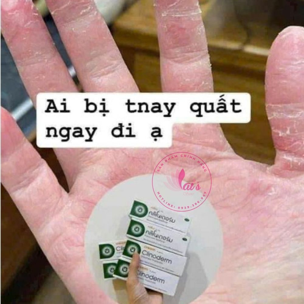 Kem Bôi Ngứa Vảy Nến Thái Lan Clinoderm Cream 15g Viêm Da Cơ Địa, Tổ Đỉa