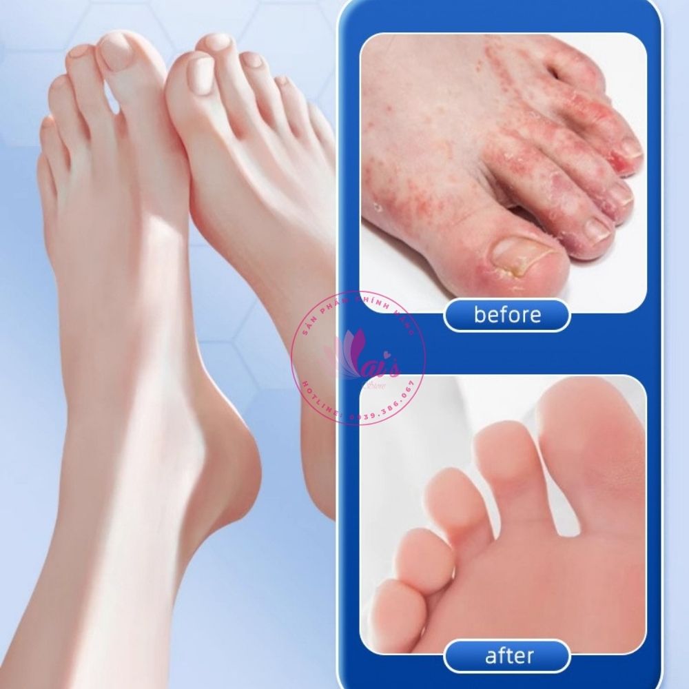 Mặt Nạ Ủ Chân Thảo Dược Khử Mùi Hôi Chân Doumei