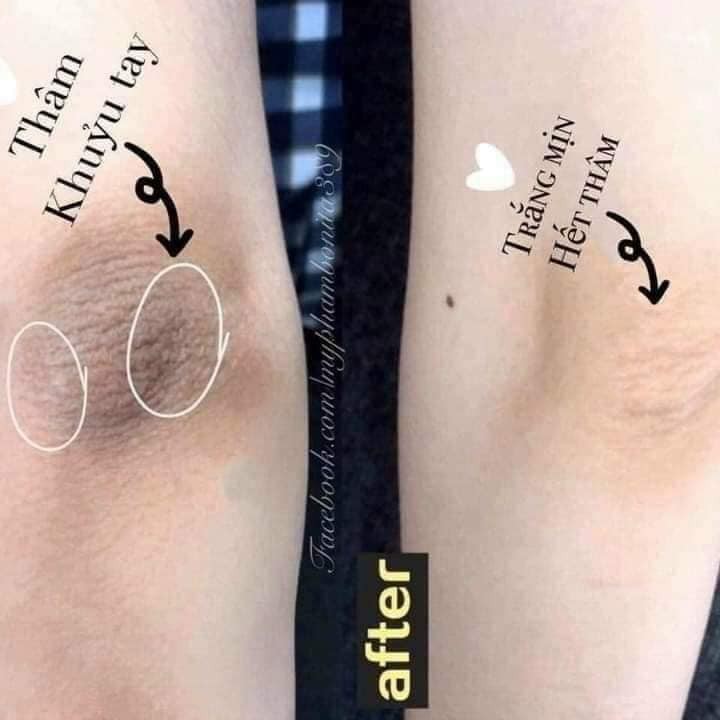 Kem Trị Thâm Nách 88 Total White Underarm Cream Thái Lan 35g