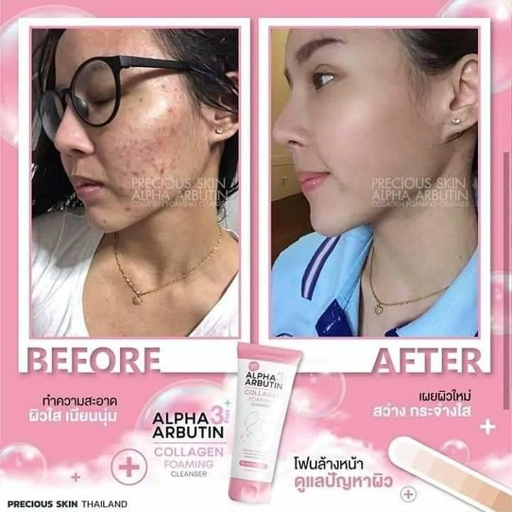 Sữa Rửa Mặt Trắng Da Ngừa Mụn Alpha Arbutin Collagen Foaming Cleanser Thái Lan 120ml