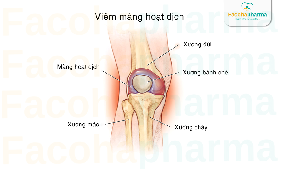 Viêm hoạt dịch khớp gối