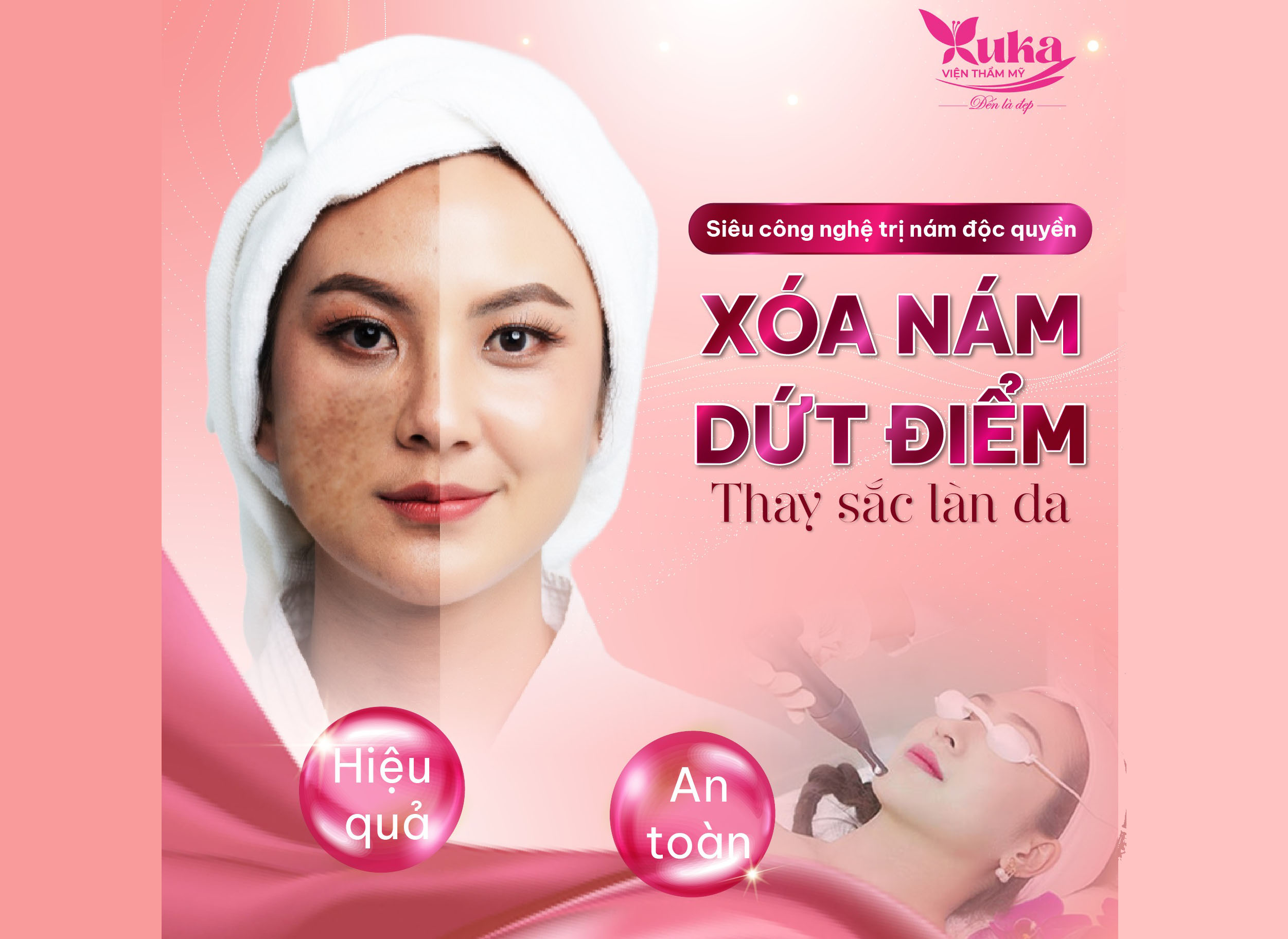 ✨XÓA NÁM DỨT ĐIỂM - THAY SẮC LÀN DA