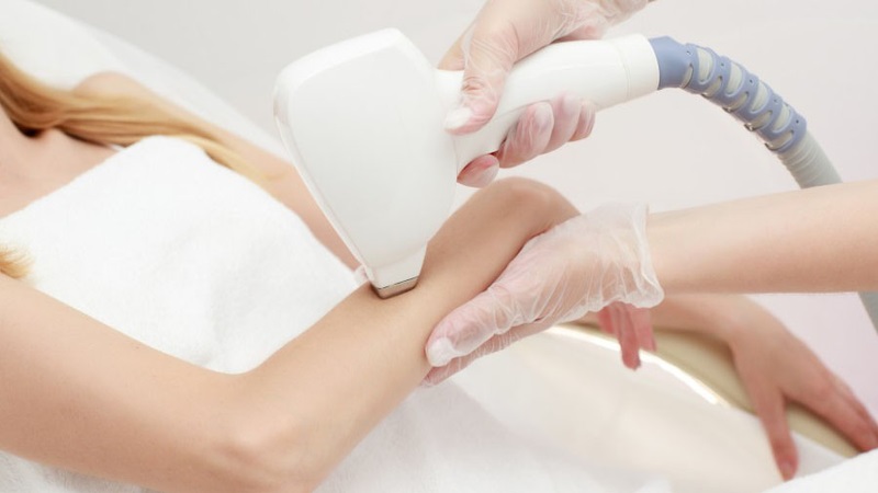 Triệt lông tay vĩnh viễn có hiệu quả không? Ưu và nhược điểm của các cách tẩy lông tay hiện nay
