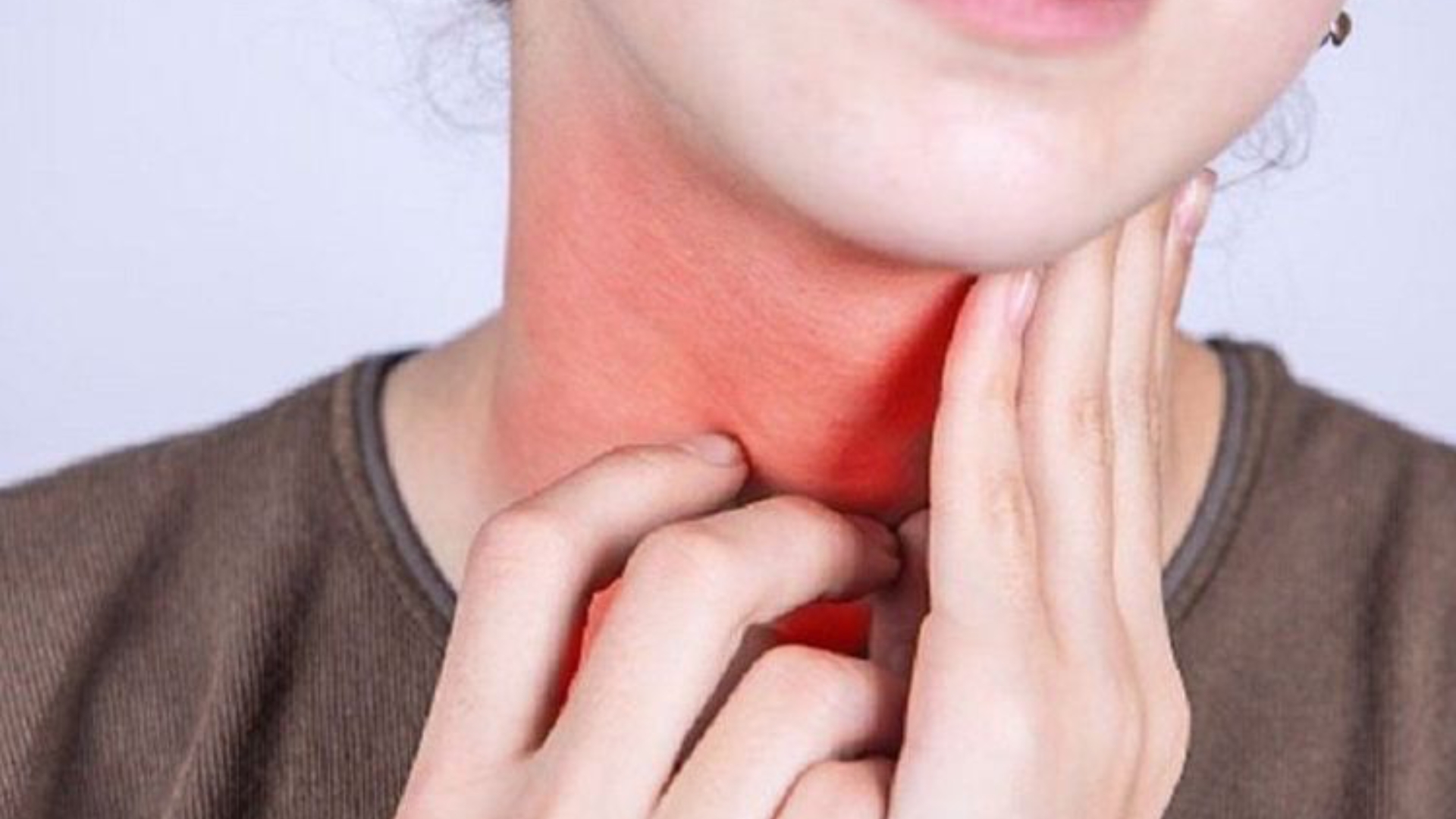 Alpha Melain Là Thuốc Gì? Công Dụng & Cách Sử Dụng Đúng Cách