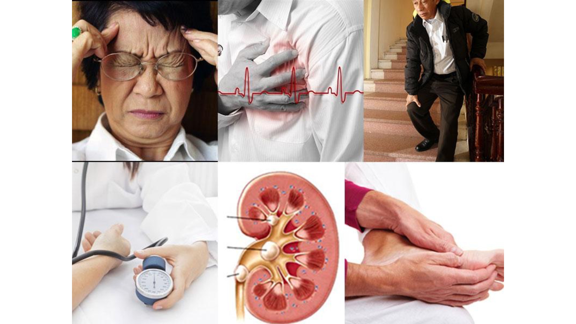 Nattokinase 4000FU Là Gì? Cách Sử Dụng Đúng Để Đạt Hiệu Quả Tối Ưu