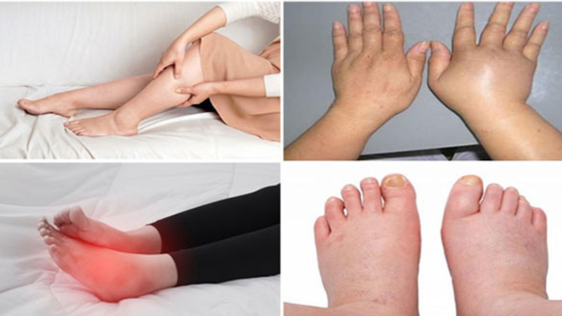 Decapa Là Gì? Công Dụng, Thành Phần Và Cách Sử Dụng