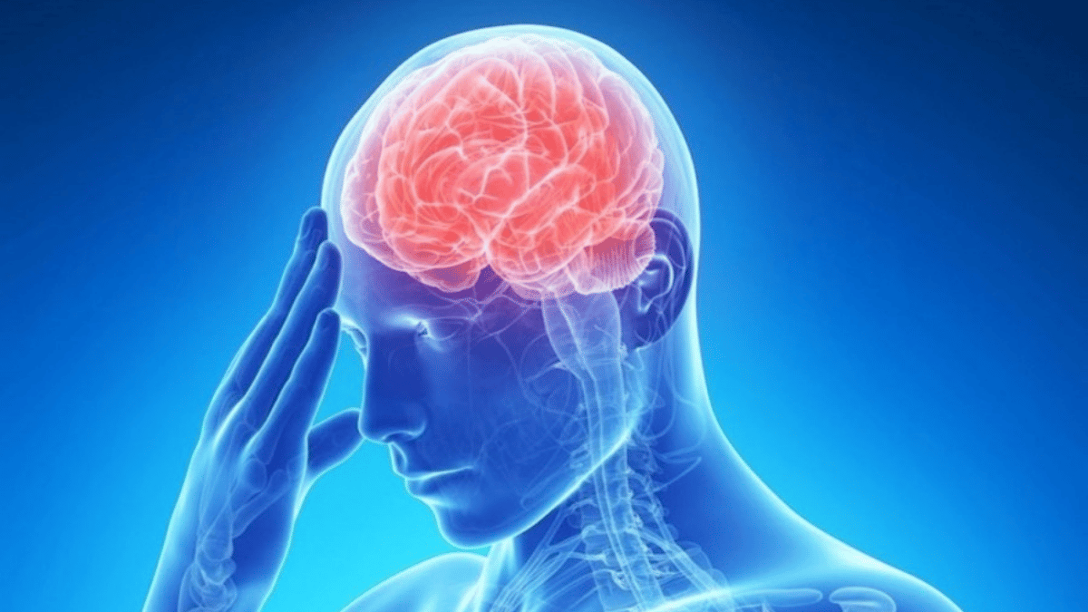 Hình ảnh mô phỏng thiếu máu não