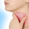 Viêm họng cấp