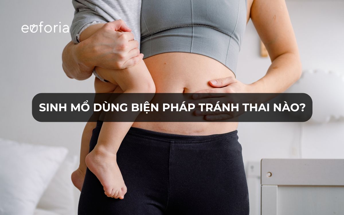 Sinh mổ thì dùng biện pháp tránh thai nào tốt?