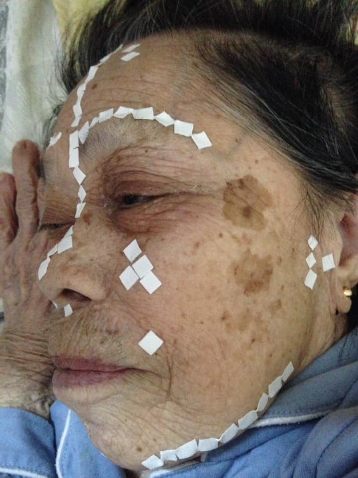 DIỆN CHẨN GIÚP PHỤC HỒI CỘT SỐNG