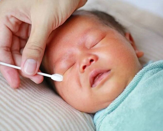 Trẻ sơ sinh bị đau mắt đỏ chăm sóc như thế nào để nhanh khỏi?