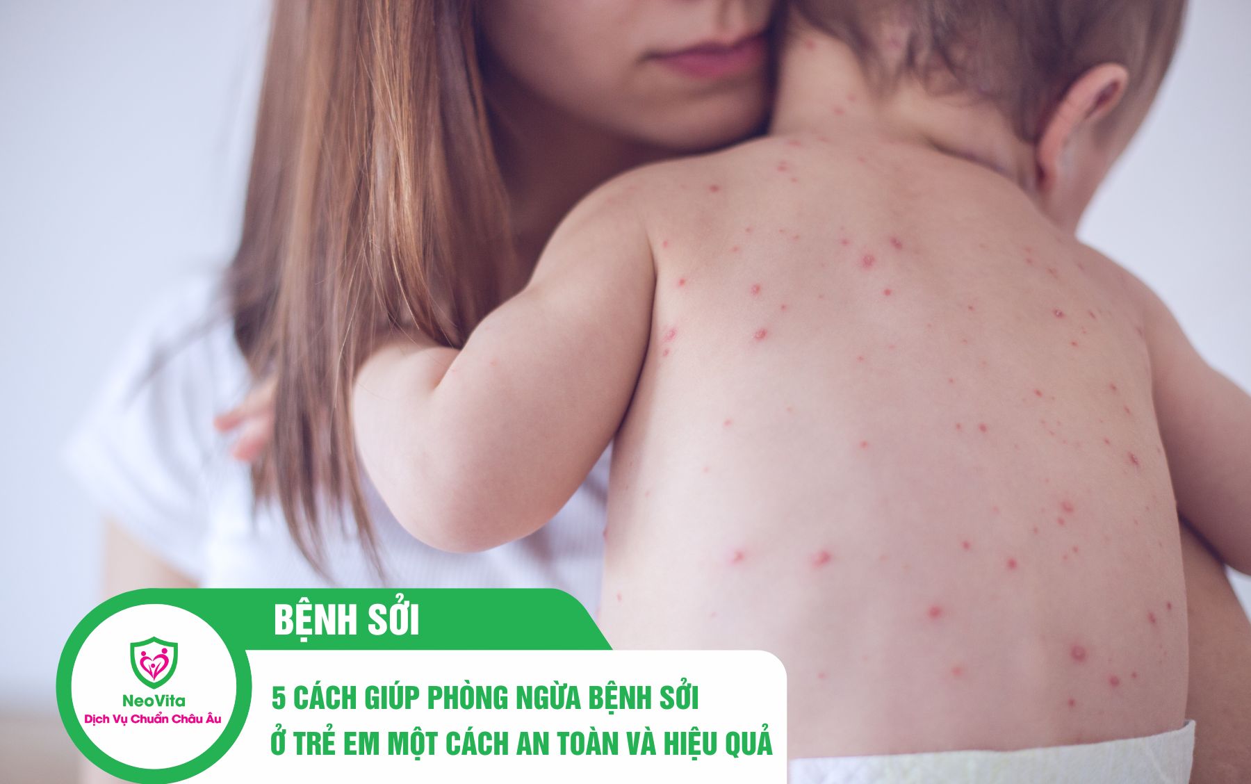 5 Cách Giúp Phòng Ngừa Bệnh Sởi ở Trẻ Em Một Cách An Toàn và Hiệu Quả