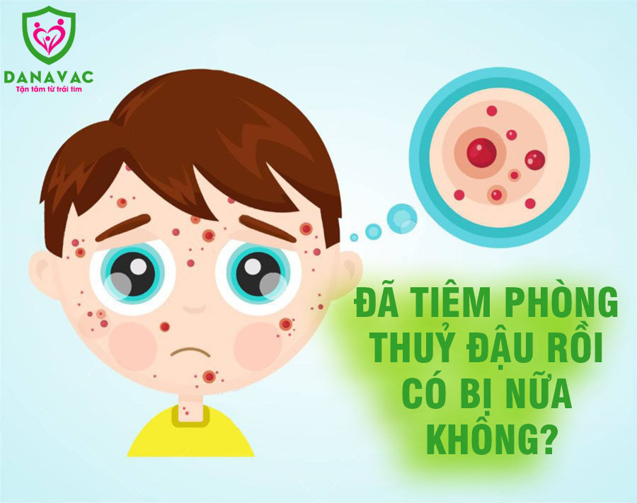 Đã tiêm phòng thuỷ đậu rồi có bị nữa không?