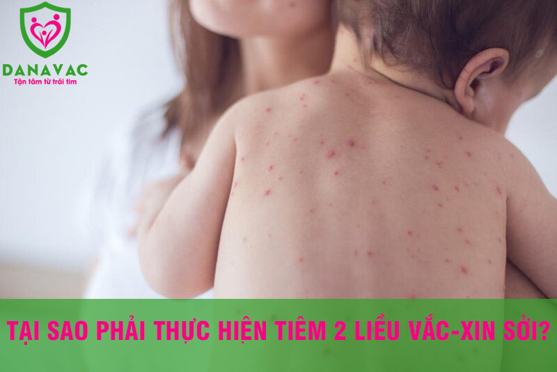 Tại sao phải thực hiện tiêm 2 liều vắc-xin sởi?