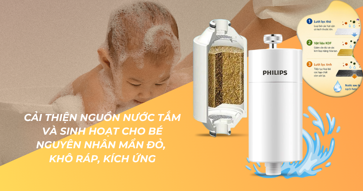 Em bé thường xuyên bị ngứa – Có thể nguyên nhân đến từ nguồn nước sinh hoạt?