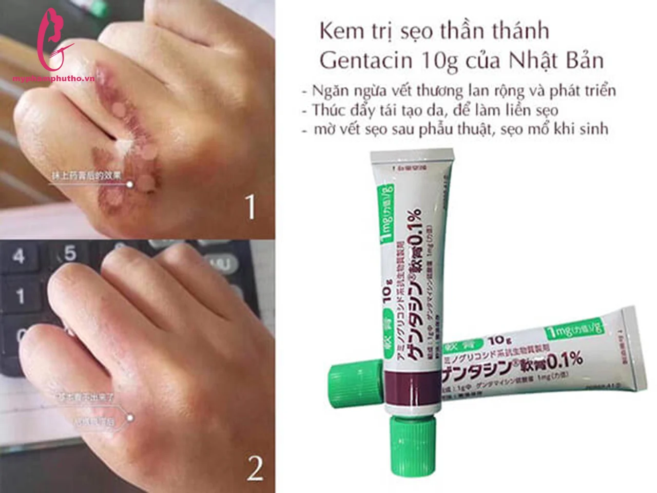 Kem trị sẹo, trị thâm Gentacin Nhật Bản