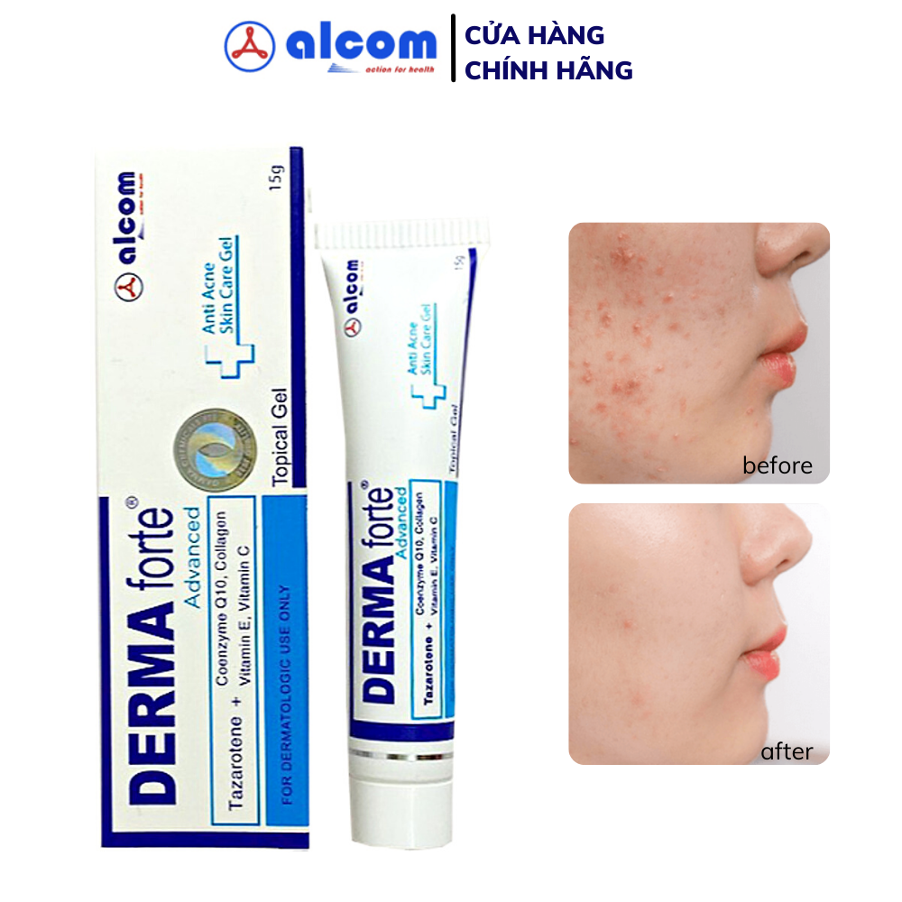 Chấm mụn Derma Forte 15g