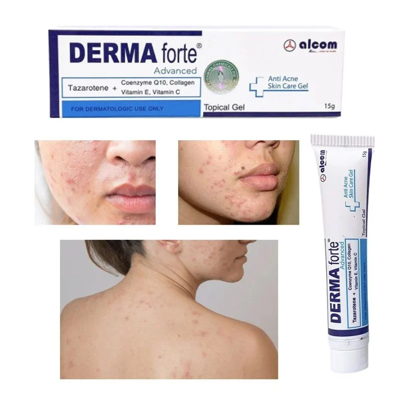 Chấm mụn Derma Forte 15g