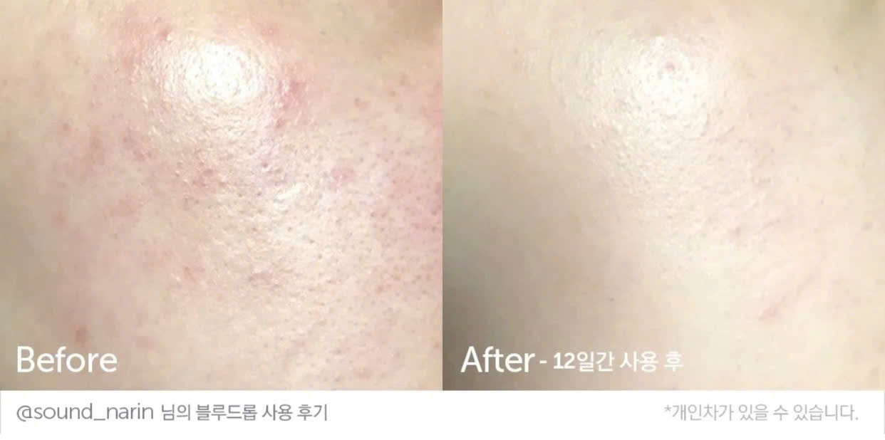 Klairs - Serum Vitamin C 35ml