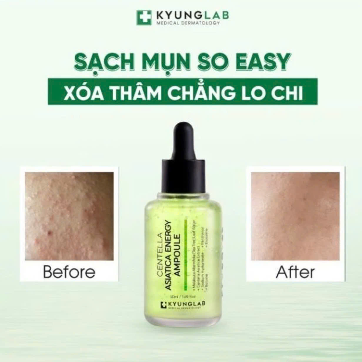 Kyunglab - Serum Centella Asiatica Energy 50ml
