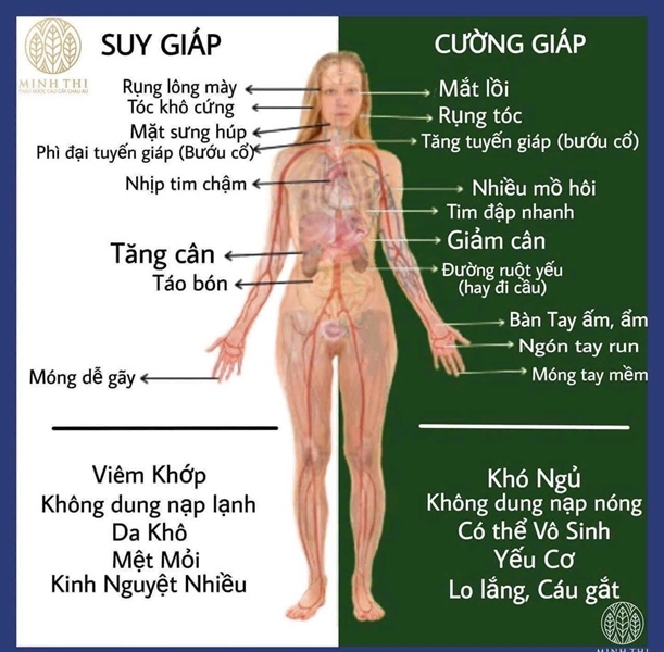 Viên Uống Hỗ Trợ Tuyến Giáp, Cường Giáp Mercazole 5mg – Giải pháp chăm sóc sức khỏe tuyến giáp
