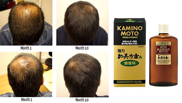 Dầu gội kích thích mọc tóc Kaminomoto Higher Strength – Trị Rụng Tóc Nặng