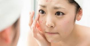 Top 7 Sai Lầm Khi Chăm Sóc Da Mặt Mà Bạn Nên Tránh