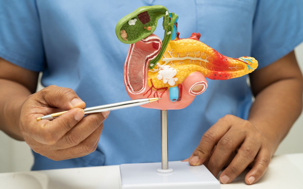 Viêm Tụy Cấp Tính Nên Ăn Gì? Thực Đơn Phục Hồi Tụy Tốt