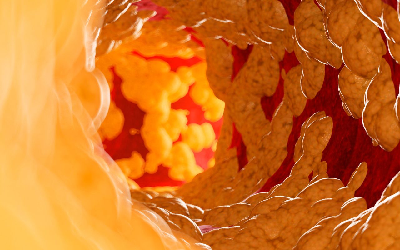Mỡ Trong Máu Nên Ăn Gì? Thực Phẩm Giảm Cholesterol Tốt