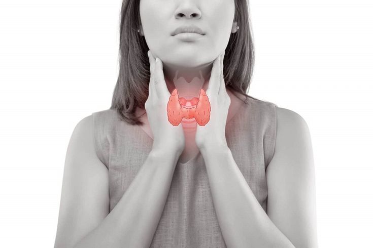 U tuyến giáp là gì? Triệu chứng, nguyên nhân và cách điều trị