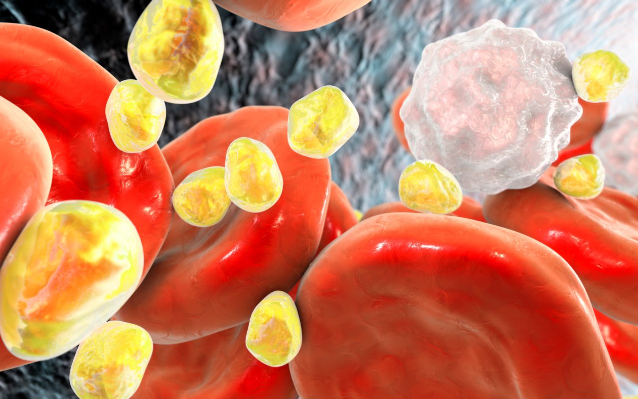 Rối Loạn Lipid Máu Nên Ăn Gì? Giảm Cholesterol Hiệu Quả